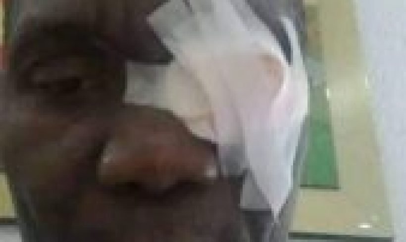 Controverse autour de l’attaque armée visant L’ex-Sénateur Joseph Lambert Controverse autour de l’attaque armée visant L’ex-Sénateur Joseph Lambert